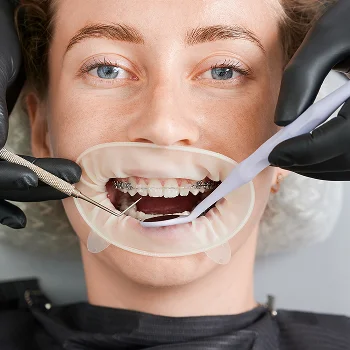 mouth-checking-image